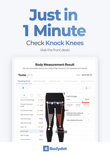 Knock Knees